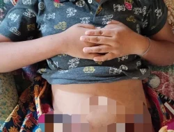 Ketua Komisi II DPRD Nunukan Kunjungi Adik Riezwan, Bocah Semangkadu yang Berjuang Lawan Tumor Ganas di Perut